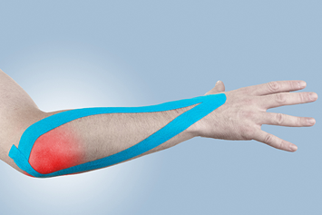 Epicondilita laterala sau Tennis elbow